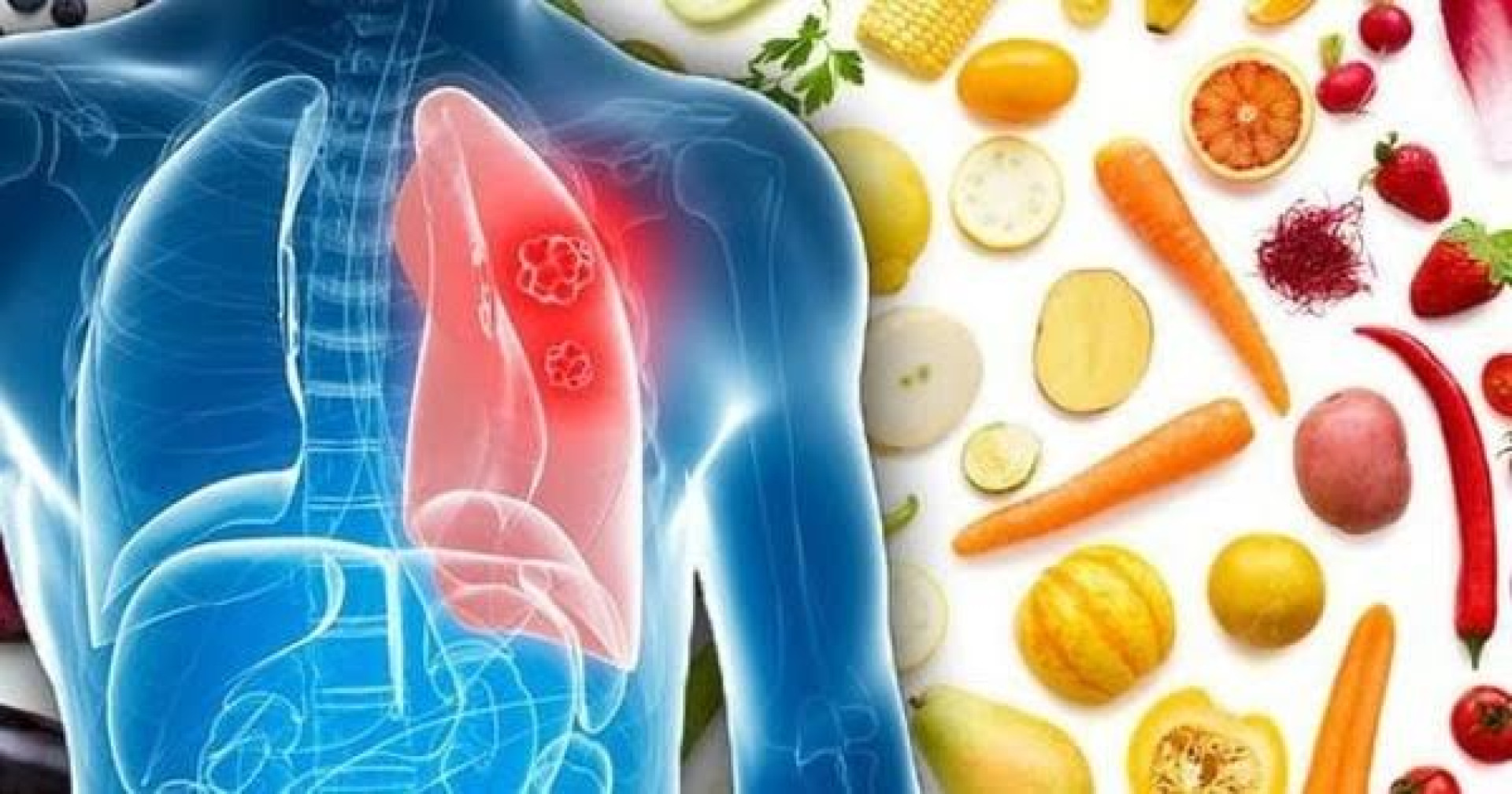  Chế Độ Dinh Dưỡng Và Cẩm Nang Chăm Sóc Người Cao Tuổi Bị Viêm Phổi